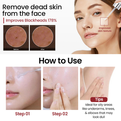 🔥LAST DAY 75% OFF🔥 ✨ Grunsify® Peel Show Glow — Where Exfoliation Meets Radiance