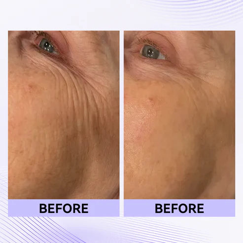 🔥LAST DAY 75% OFF🔥🌸 Perfection Primer Tightener – New Formula, Ultimate Lift & Smooth Finish ✨
