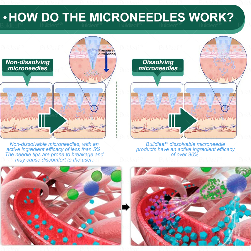 Mayo Clinic Recommended I Official Store | Cheemex® SMGT-GLP-1 Nano Microneedle Patch with Collagen Peptides &Matrixyl 3000