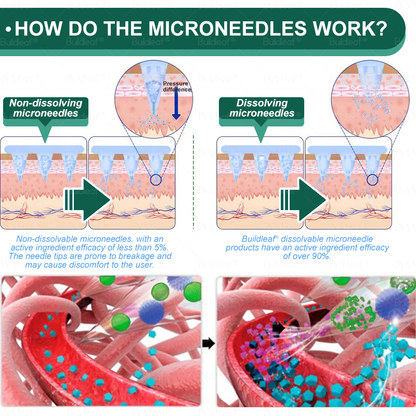Mayo Clinic Recommended I Official Store | Cheemex® SMGT-GLP-1 Nano Microneedle Patch with Collagen Peptides &Matrixyl 3000