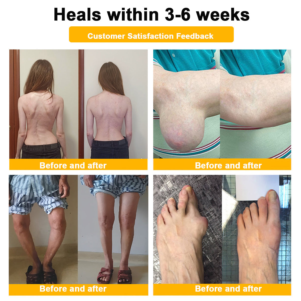 Final Day 79% OFF 🔥AQA™ Botulinum & Bee Essence Pain-Relief Bone Healing Cream