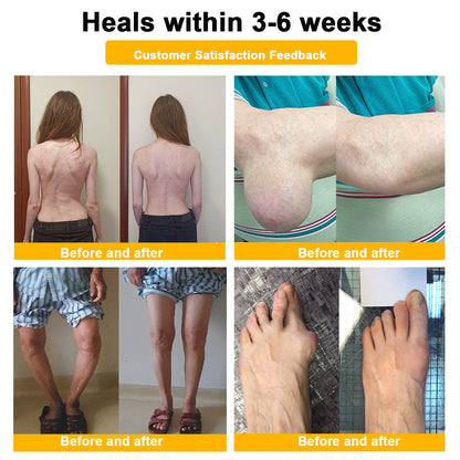 Final Day 79% OFF 🔥AQA™ Botulinum & Bee Essence Pain-Relief Bone Healing Cream