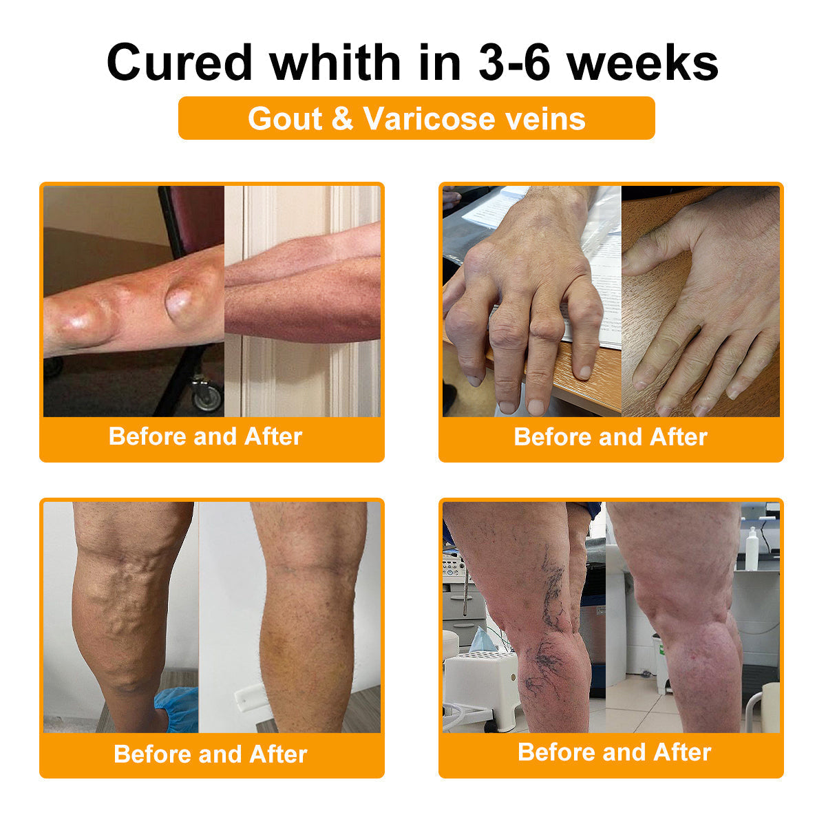 Final Day 79% OFF 🔥AQA™ Botulinum & Bee Essence Pain-Relief Bone Healing Cream