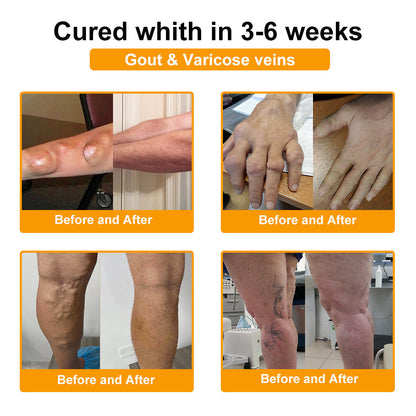 Final Day 79% OFF 🔥AQA™ Botulinum & Bee Essence Pain-Relief Bone Healing Cream