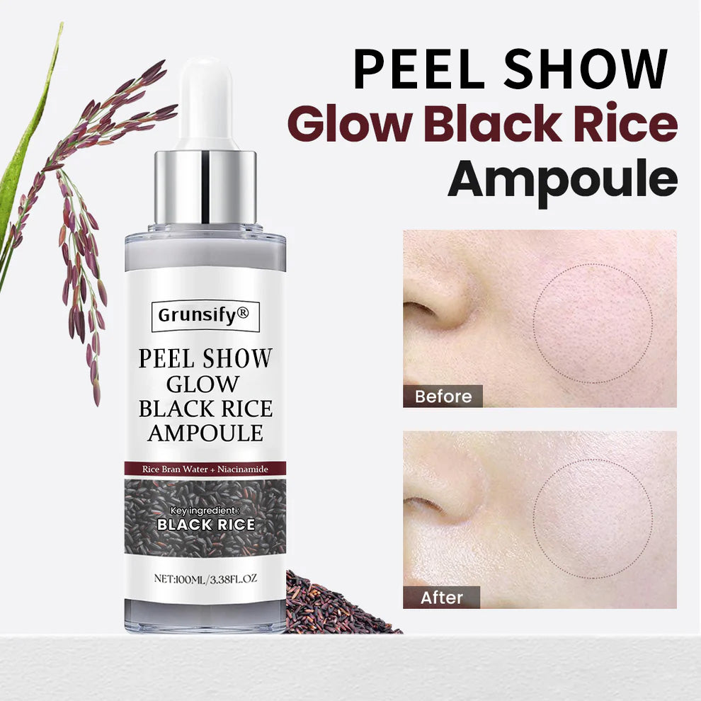 🔥LAST DAY 75% OFF🔥 ✨ Grunsify® Peel Show Glow — Where Exfoliation Meets Radiance