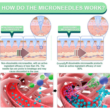 80% OFF Final Hours | Grunsify® NIDDK-Tirzepatide Nano Microneedle Patch – FDA Certified Weight Loss Solution