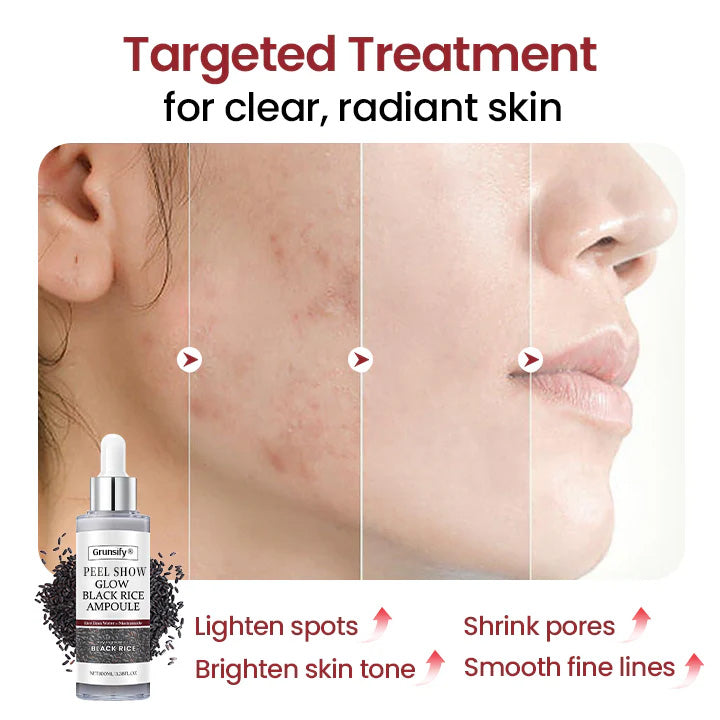 🔥LAST DAY 75% OFF🔥 ✨ Grunsify® Peel Show Glow — Where Exfoliation Meets Radiance