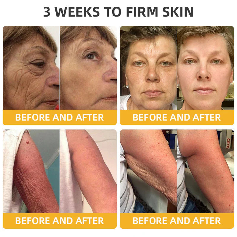 Made and Shipped from USA ✨ Cheemex® Bee Toxin Skin Restoration Cream ⏰ LAST DAY 80% OFF✨✨