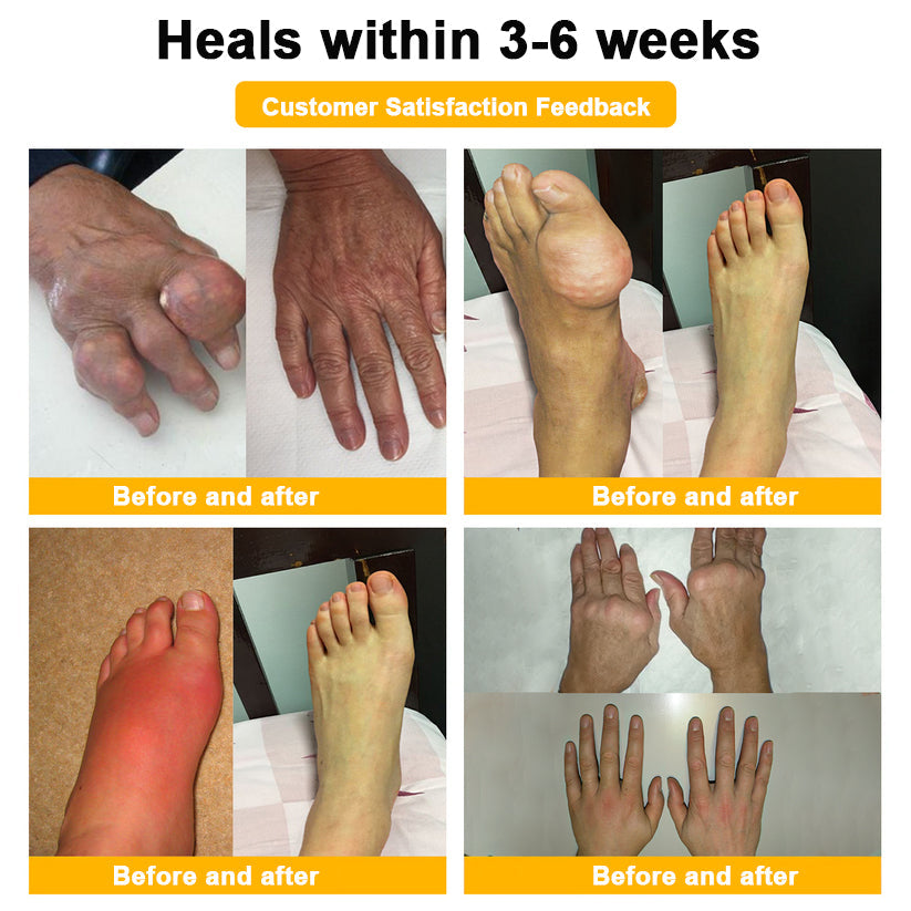 Final Day 79% OFF 🔥AQA™ Botulinum & Bee Essence Pain-Relief Bone Healing Cream
