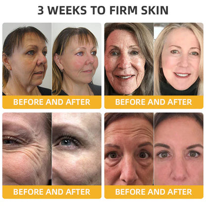 Made and Shipped from USA ✨ Cheemex® Bee Toxin Skin Restoration Cream ⏰ LAST DAY 80% OFF✨✨