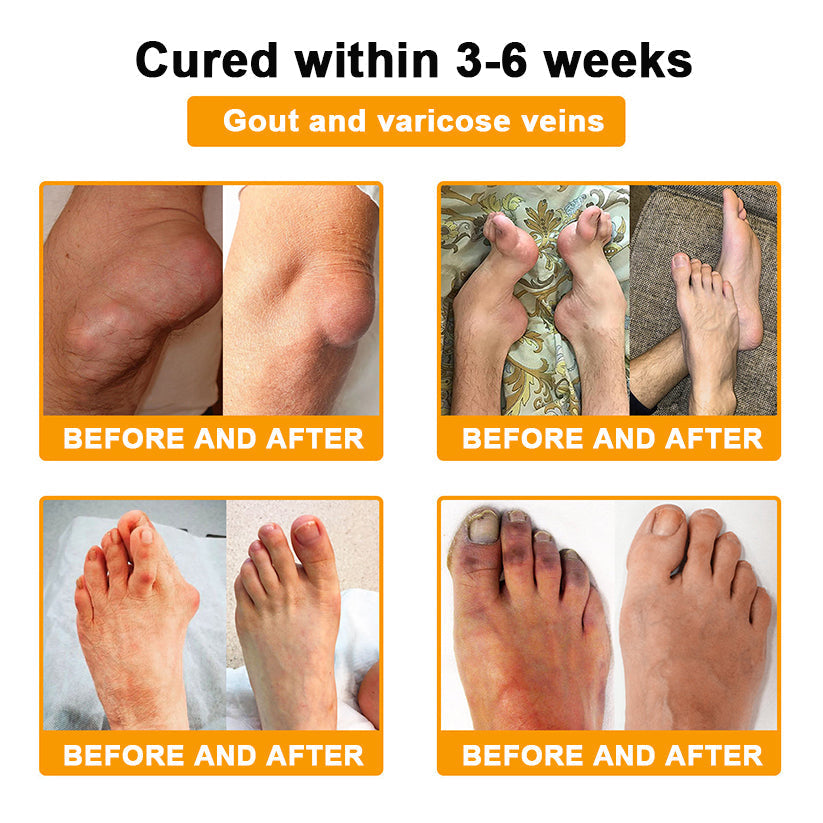Final Day 79% OFF 🔥AQA™ Botulinum & Bee Essence Pain-Relief Bone Healing Cream