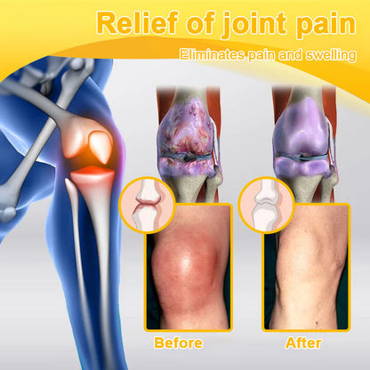 Final Day 79% OFF 🔥AQA™ Botulinum & Bee Essence Pain-Relief Bone Healing Cream