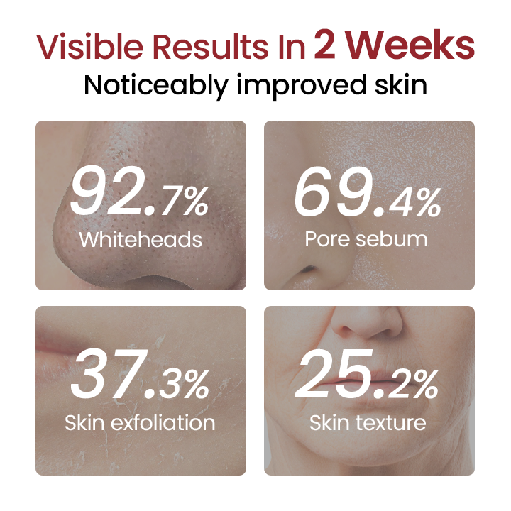 🔥LAST DAY 75% OFF🔥 ✨ Grunsify® Peel Show Glow — Where Exfoliation Meets Radiance