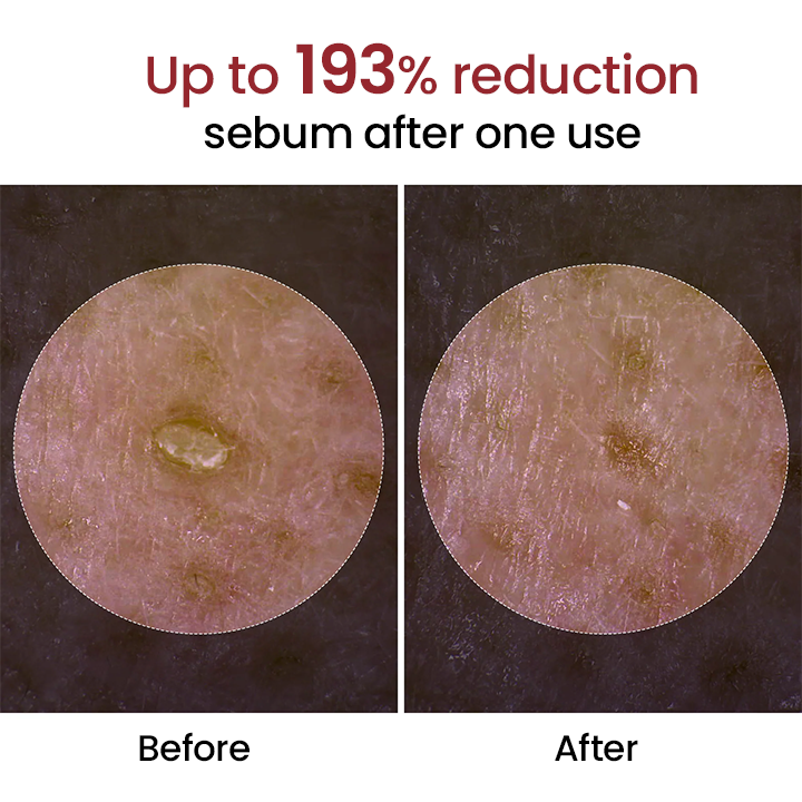 🔥LAST DAY 75% OFF🔥 ✨ Grunsify® Peel Show Glow — Where Exfoliation Meets Radiance