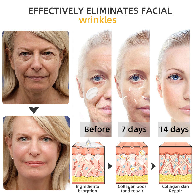 💐💞Lovilds™ BeeLift Anti-Aging Firming Cream,Address Crepe & Sagging(🔥74% Off for a Limited Time!)