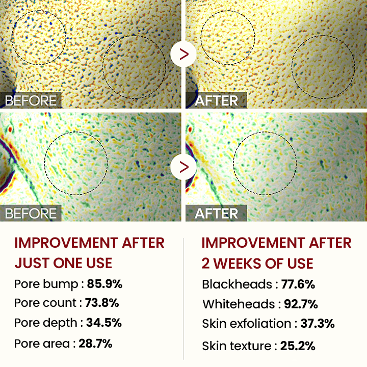 🔥LAST DAY 75% OFF🔥 ✨ Grunsify® Peel Show Glow — Where Exfoliation Meets Radiance