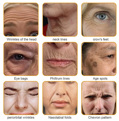 🔥LAST DAY 75% OFF🔥LOVILDS™ Bee Toxin Wrinkle Removal Cream