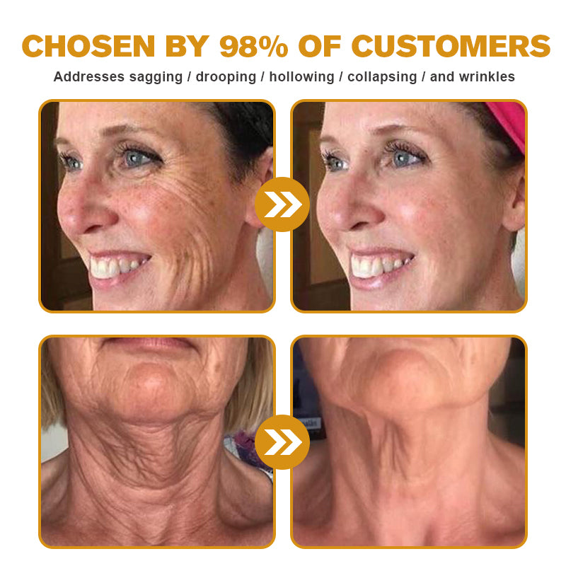 🔥LAST DAY 75% OFF🔥LOVILDS™ Bee Toxin Wrinkle Removal Cream