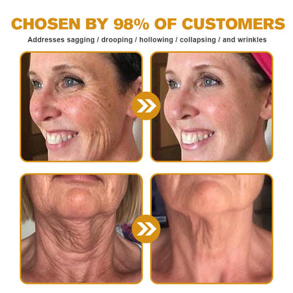 🔥LAST DAY 75% OFF🔥LOVILDS™ Bee Toxin Wrinkle Removal Cream