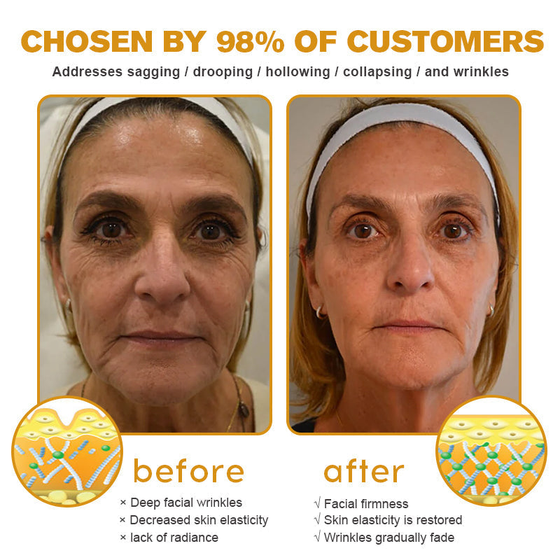 🔥LAST DAY 75% OFF🔥LOVILDS™ Bee Toxin Wrinkle Removal Cream