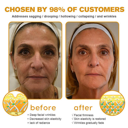 🔥LAST DAY 75% OFF🔥LOVILDS™ Bee Toxin Wrinkle Removal Cream